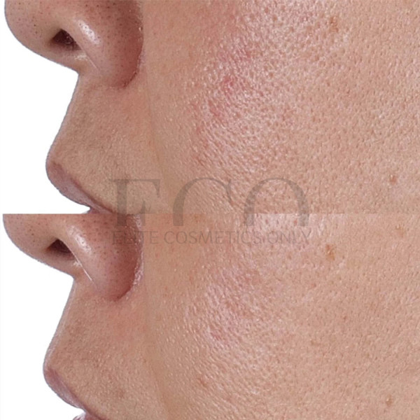 Тонік для обличчя з ефектом ліфтингу Perricone MD High Potency Classics Face Finishing &Firming Toner, 118 мл